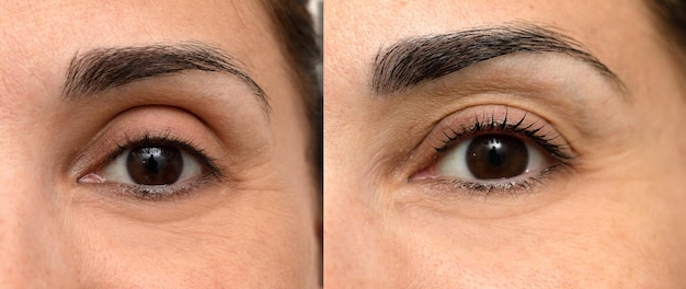 Oeil de femme avant et après traitement de stratification des cils