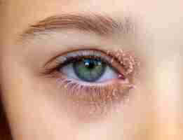 Photo l'œil d'une petite fille souffrant de dermatite atopique oculaire ou d'eczéma des paupières
