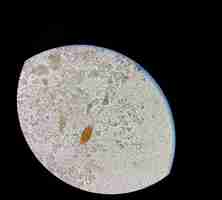 Photo oeufs de trichuris trichiura (trichure) dans les selles, analyser au microscope