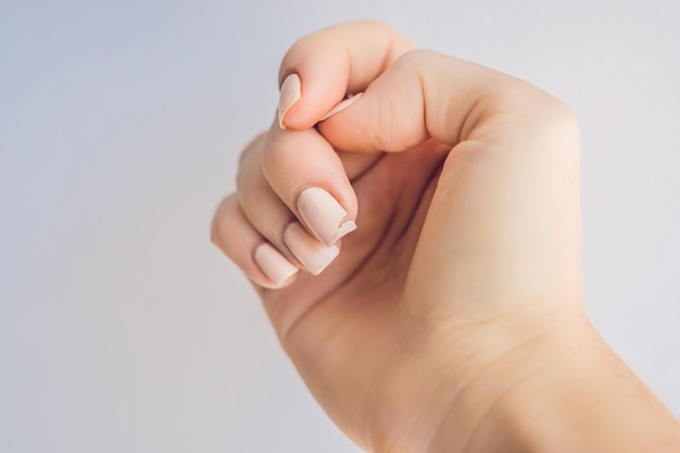 Ongle cassé sur la main d'une femme avec une manucure sur fond vert