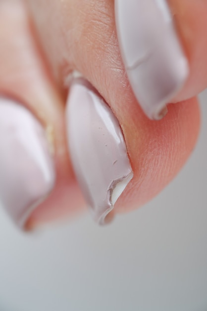 Ongles féminins cassés avec manucure concept d'ongles faibles et cassants