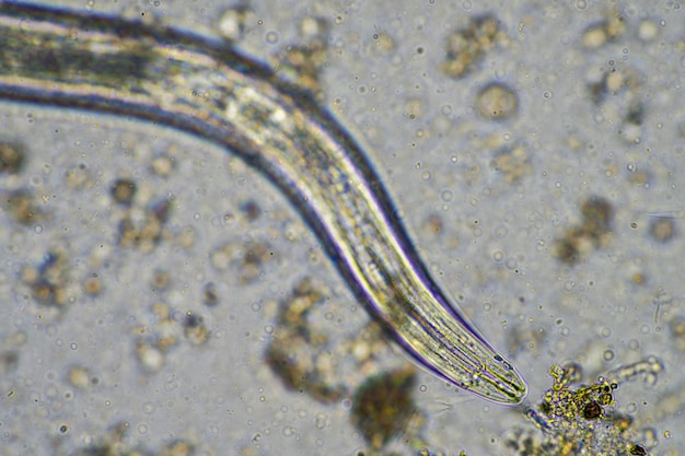 Organismes microbes du sol dans un échantillon de sol et de compost champignons et champignons et sous le microscope dans l'agriculture régénérative en australie