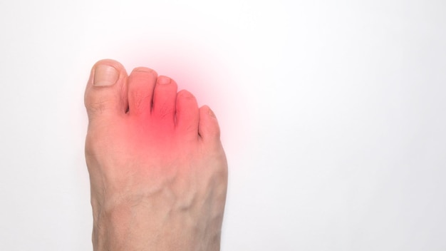 Photo les orteils du pied droit d'une personne avec une marque rouge représentant la douleur