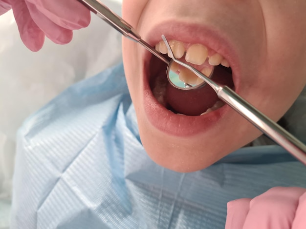 L'orthodontiste de dentiste dans la clinique dentaire traite des dents d'enfant