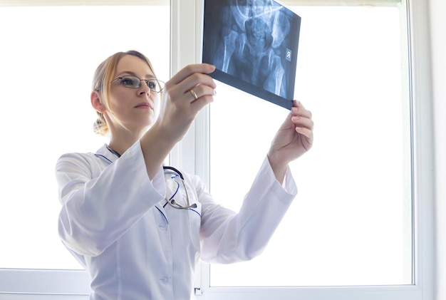 Ostéotomie du fémur Avant l'opération du fémur, le médecin examine la radiographie Focus sur la femme