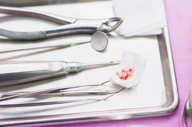 outil dentiste, varices équipement pour la restauration fixe