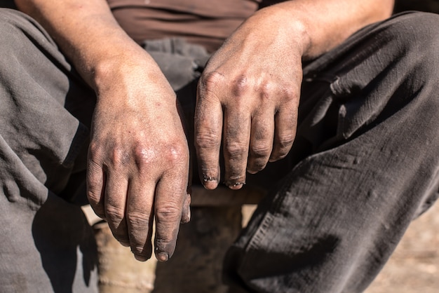 Ouvrier brûleur de charbon de bois avec les mains sales. Ouvrier, mains