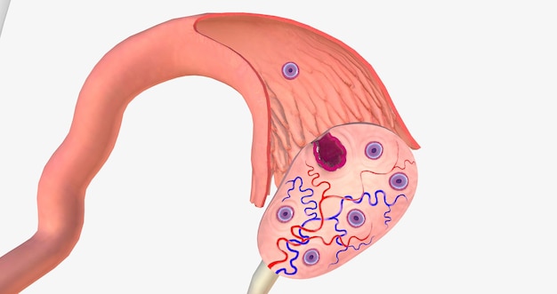 L'ovulation est le processus de libération d'un ovule mature de l'ovaire dans la trompe de Fallope de l'utérus