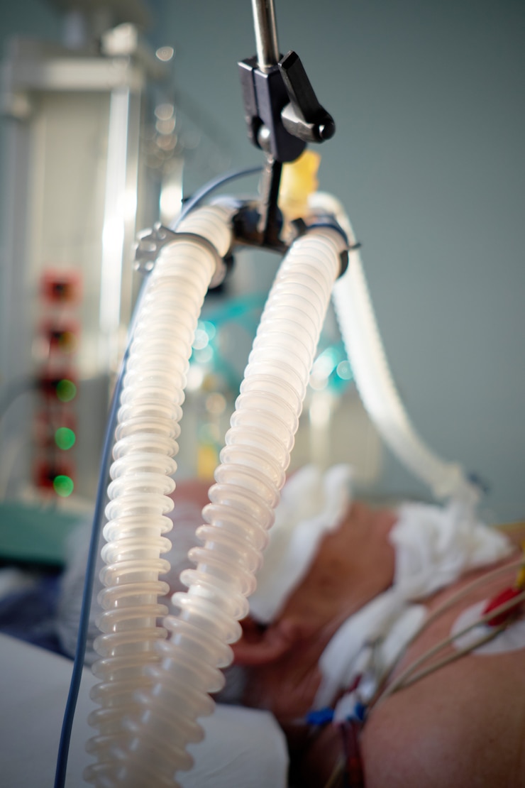 Photo pandémie de coronavirus. vue rapprochée d'un patient atteint de pneumonie à coronavirus dans un état critique. intubé senior sous ventilateur couché dans le coma dans le service de soins intensifs.