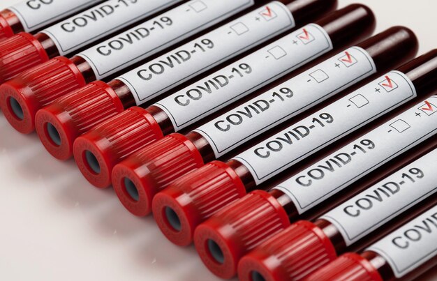 Pandémie mondiale d'infection dangereuse à coronavirus. Covid-19