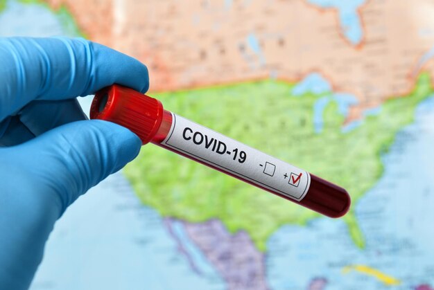 Pandémie mondiale d'infection dangereuse à coronavirus. Covid-19