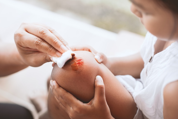 Photo le parent aide son enfant à se faire une blessure au genou après un accident