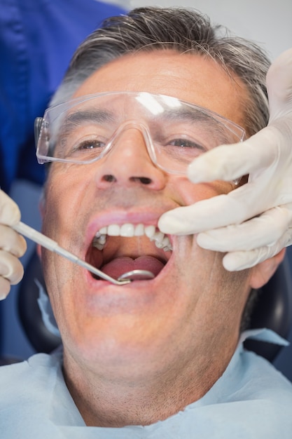 Patient bouche ouverte et examen dentiste