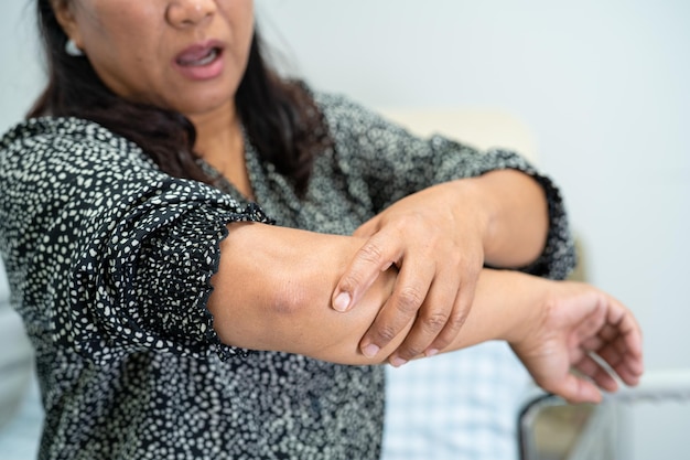 Une patiente asiatique touche et ressent de la douleur dans son coude et son bras concept médical sain