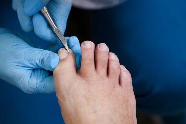 Pédicure de pied en gros plan, le maître enlève une partie de l'ongle avec une pince, soin des ongles.