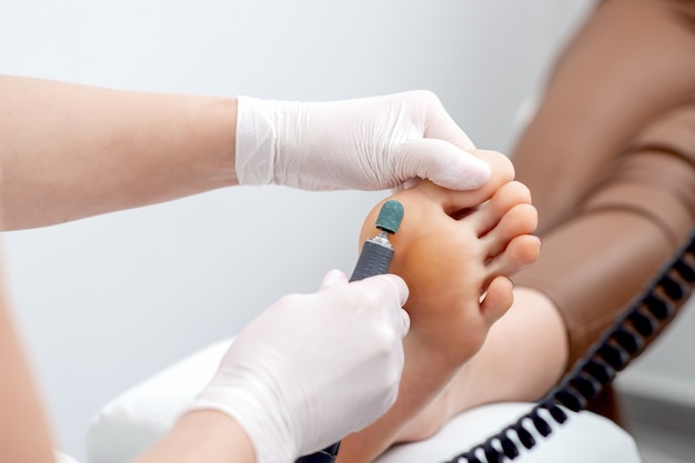 Peeling pieds procédure de pédicure de callosités à pied par les mains du podiatre en gants blancs au salon de beauté