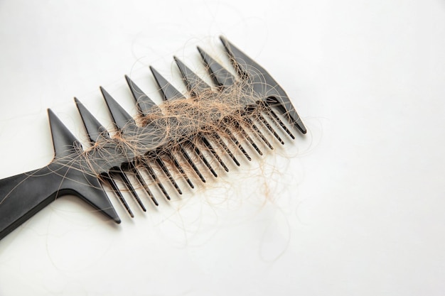 Peigne avec cheveux perdus sur table lumineuse Problème d'alopécie