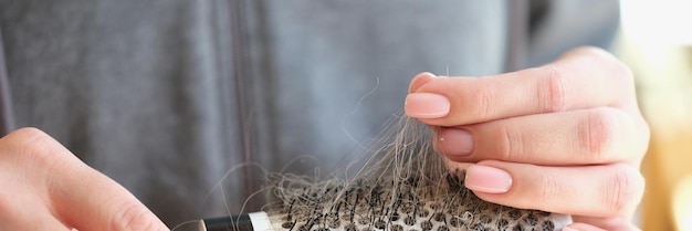 Peigne avec les cheveux tombés dans les mains des femmes gros plan problème de faiblesse de la calvitie et de la perte de cheveux
