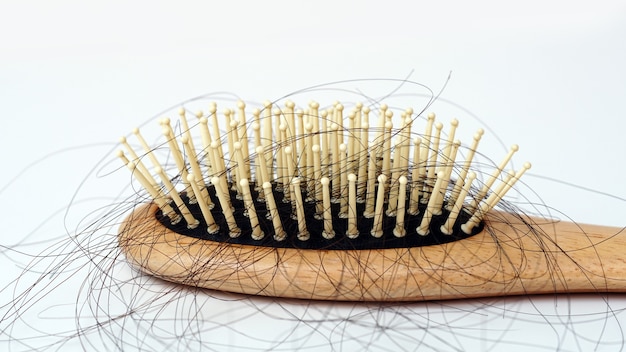La perte de cheveux dans les cheveux de peigne tombent tous les jours un problème grave sur fond blanc
