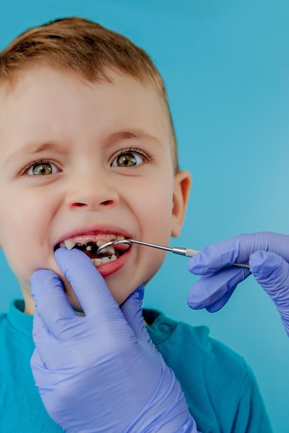 Le petit patient ne veut pas ouvrir la bouche du dentiste sur fond bleu Dantist traite les dents vue rapprochée du dentiste traitant les dents du petit garçon dans le cabinet du dentiste