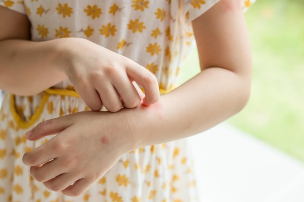 Petite fille a des démangeaisons et des rayures sur son bras