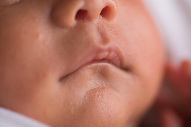 Petites lèvres de bouche et partie du corps de la langue du nouveau-né