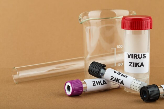 Photo de concept de virus Zika avec tube à essai