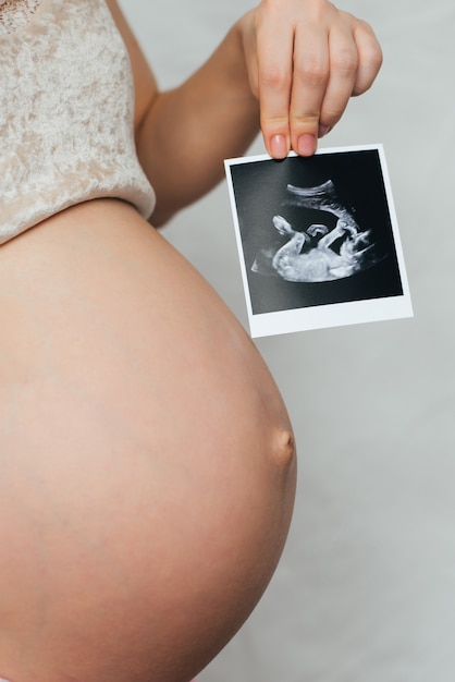 Photo d'une échographie enceinte entre les mains d'une fille enceinte