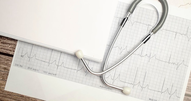 La photo en gros plan du stéthoscope et du papier résultat du test ecg