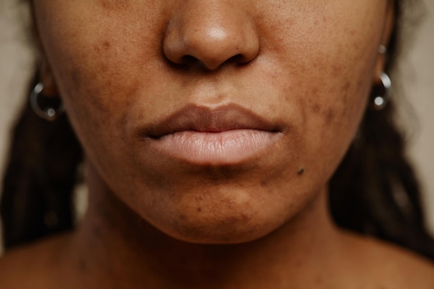 Photo macro d'une jeune femme ethnique avec une vraie texture de peau et des lèvres nues