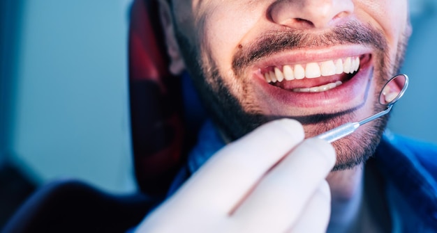 Une photo rapprochée des dents qui ont besoin d'un traitement et un médecin fait un examen pour comprendre quel type de traitement est nécessaire