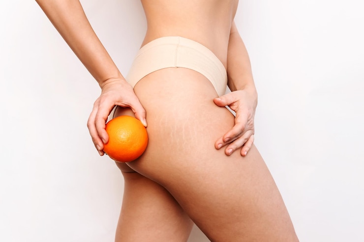 Photo photo recadrée d'une jeune femme avec de la cellulite et des vergetures blanches sur sa cuisse tenant une orange