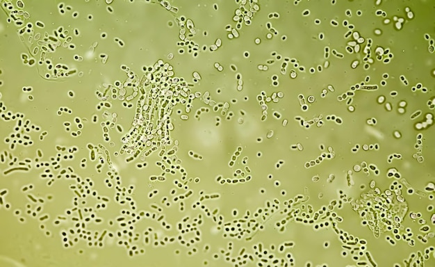 Photo photomicrographe grattage de la peau d'une colonie de champignons pour le test des champignons