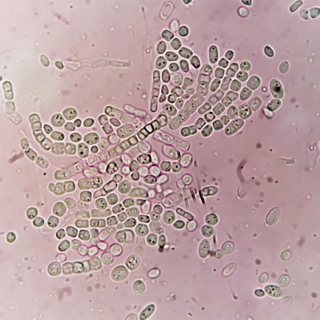 Photo photomicrographe grattage de la peau d'une colonie de champignons pour le test des champignons