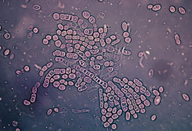 Photomicrographe Grattage de la peau d'une colonie de champignons pour le test des champignons