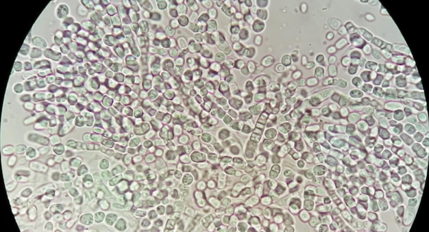 Photo photomicrographe grattage de la peau d'une colonie de champignons pour le test des champignons