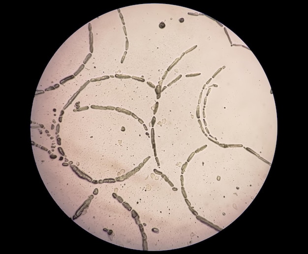 Photomicrographie de grattage de la peau pour test de champignon montrant des dermatophytes.