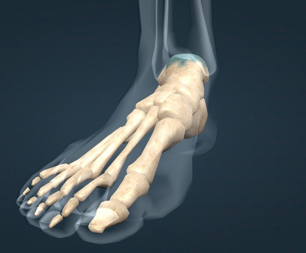 Le pied est classiquement divisé en trois zones arrière-pied médio-pied et avant-pied