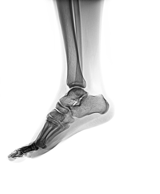 Un pied avec le pied illustré est affiché avec le mot os visible dessus.