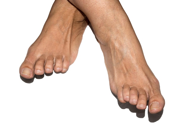 Pieds d'une femme adulte de race blanche sur fond blanc