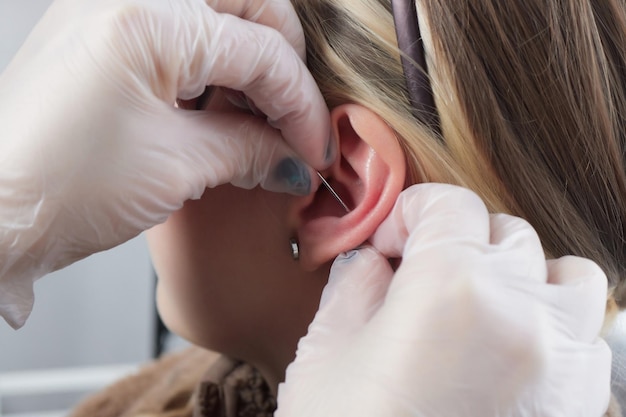 Piercings sur une conque d'oreille et piercings en hélice se bouchent