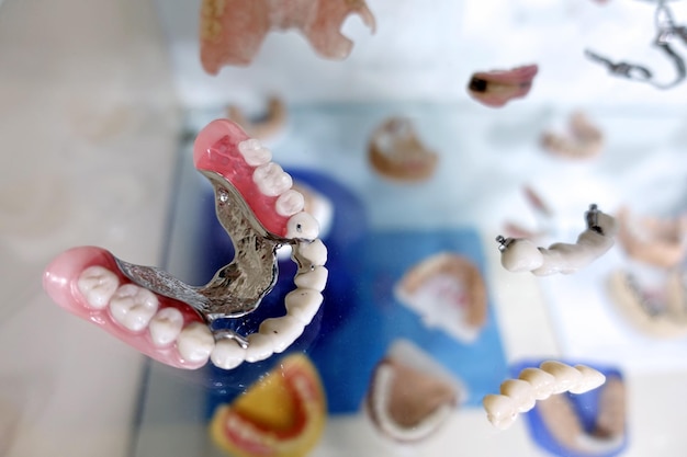 Plaque dentaire en porcelaine de zirconium dans le magasin de dentiste Photo détaillée macro