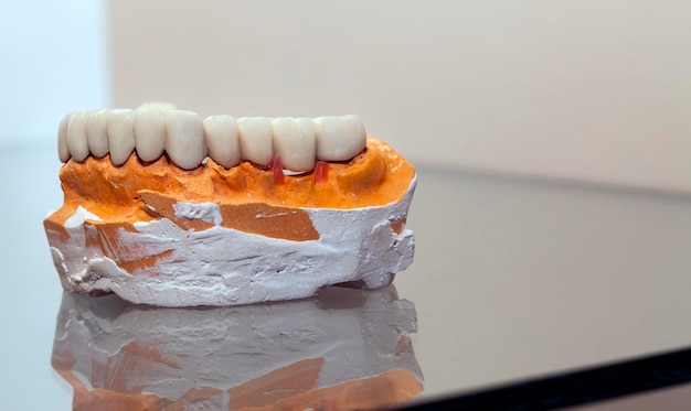 Plaque dentaire en porcelaine de zirconium dans le magasin de dentiste Photo