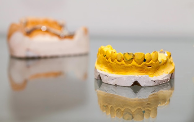 Plaque dentaire en porcelaine de zirconium dans le magasin de dentiste Photo
