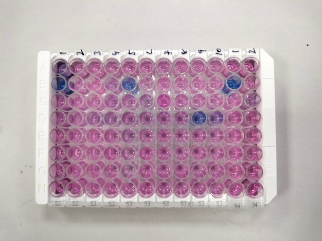 Plaque de dosage immuno-enzymatique (ELISA), immunologie, méthode de test sérologique en laboratoire médical.