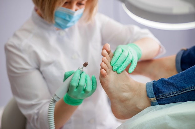 Le podiatre traite le pied à l'aide de la fraiseuse.