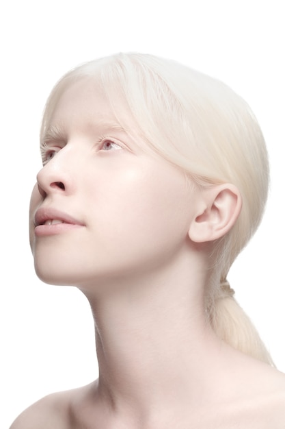 Portrait de belle femme albinos isolée sur fond de studio blanc.