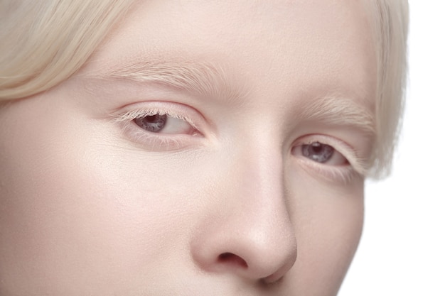 Portrait de culture de belle femme albinos isolée sur studio blanc.