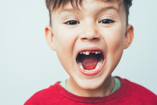 Portrait d'un enfant avec une bouche ouverte une dent est tombée