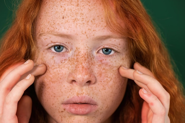 Photo portrait d'une fille rousse touchant le visage plein de taches de rousseur et yeux bleus sur vert